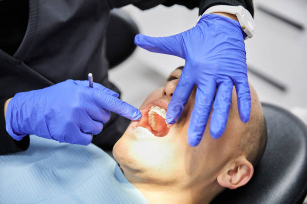 Best Dentist for Tooth Abscess  in Halls, TN